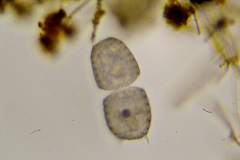 Делящаяся пополам инфузория колепс (coleps) Капля болотной воды под микроскопом: одноклеточные и многоклеточные организмы, инфузории с ресничками, водоросли со жгутиками, простейшие