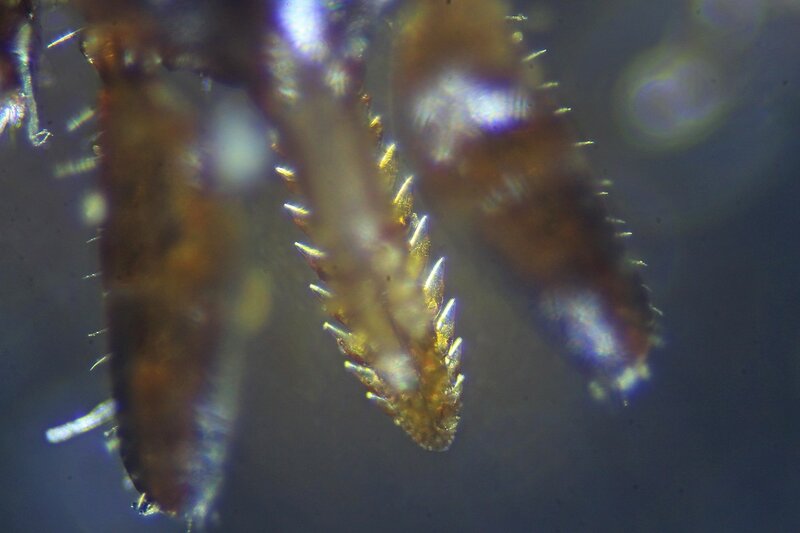 Фотография хоботка иксодового клеща под микроскопом. видны зазубрины, закрепляющие хоботок в момент укуса