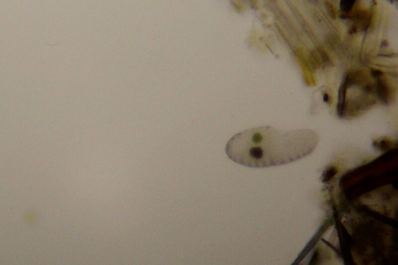 Пойманное в болотной воде простейшее под микроскопом, вероятно, инфузория (Ciliophora), возможно из парамеций (Paramecium)