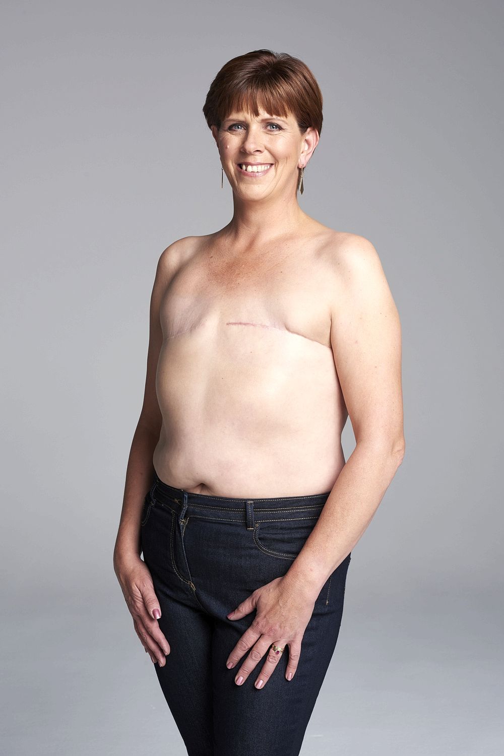женщины с ампутированными грудями фото фото 92