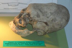 Деформированный череп найденный в древнем могильнике