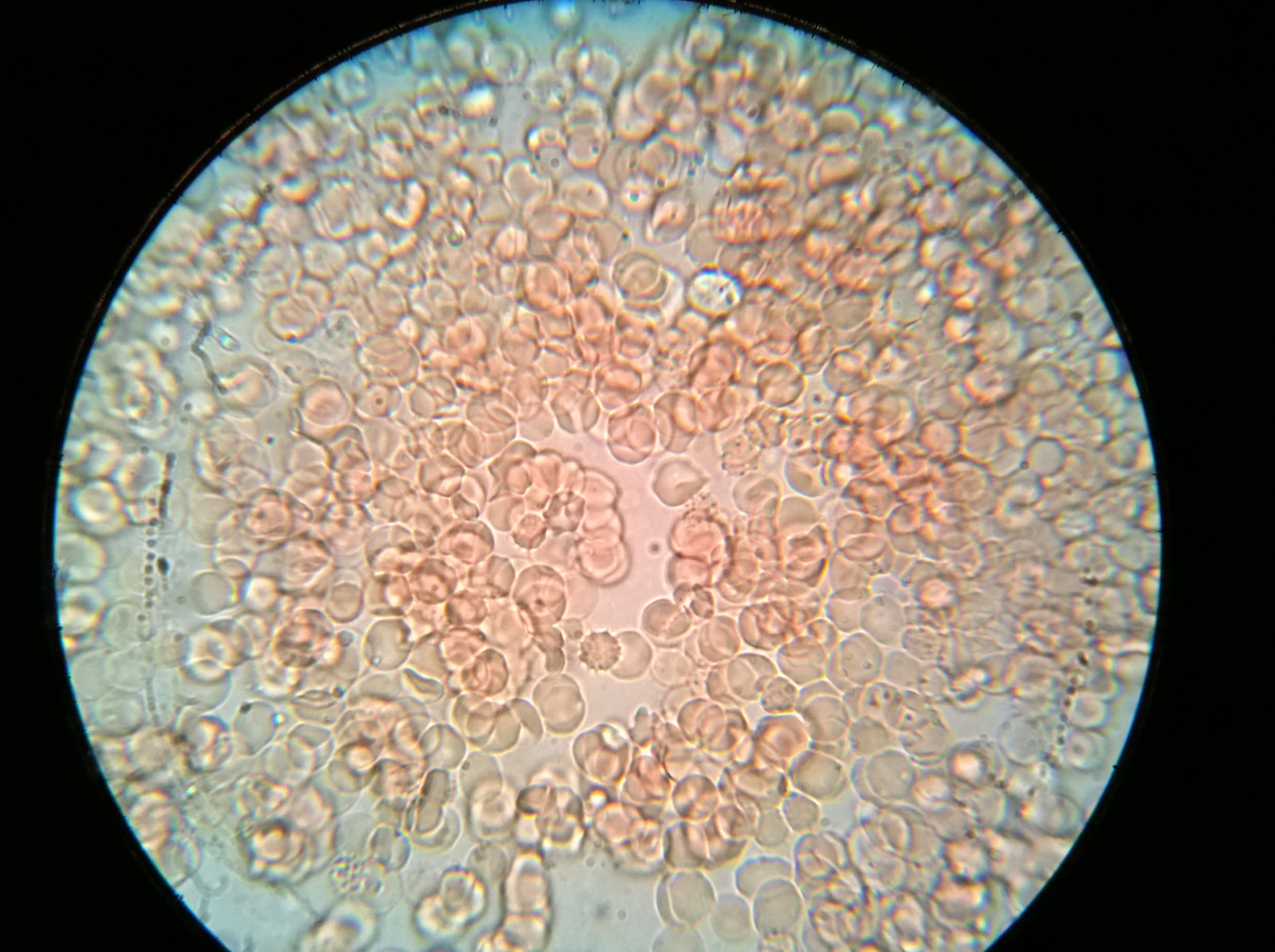 Микропрепарат бактерий. Интерференционная микроскопия гистология. Ихтиофтириоз микроскопия. Сканирующая микроскопия это в гистологии. Ультрафиолетовая микроскопия гистология.