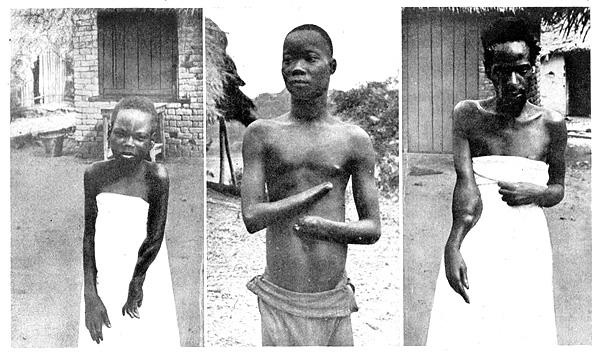 Бельгийский геноцид туземцев в Конго.  ( 70 фото )  18 + Конго, Леопольд, европейских, население, людей, время, населения, главе, женщин, убитых, держав, Африки, больше, регионе, работорговлей, Бельгии, международную, патронов, которой, колониальную