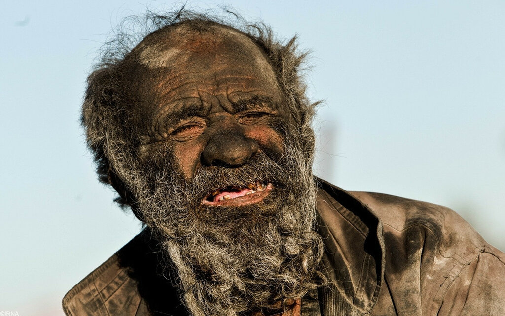 Человек, который не мылся 60 лет (7 фото)