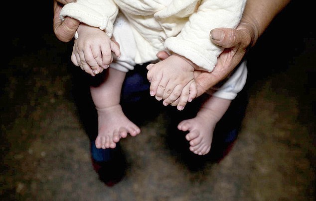 В Китае родился мальчик, у которого 31 палец