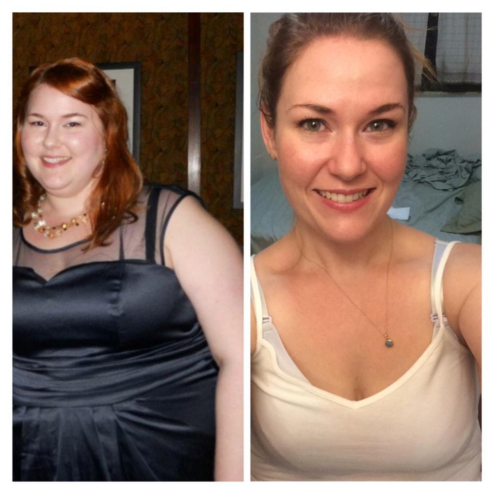 Сильно изменился за год. Похудение до и после. Лица людей до и после похудения. Толстое лицо до и после похудения. Преображение людей до и после похудения.