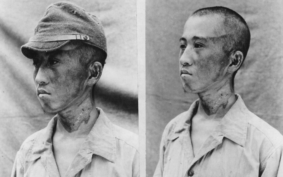 Хиросима – много лет спустя (документальные фото)